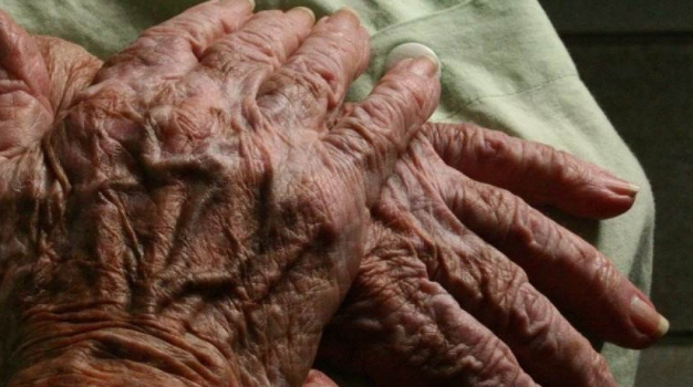 Osteoarthritis to Affect Nearly One Billion People by 2050, Study Finds